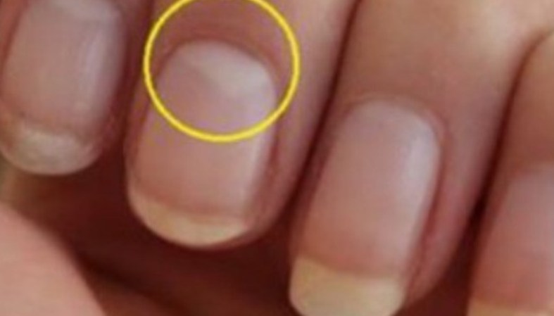 Handbook Reproduce Creed Știi ce reprezintă semicercul alb de la baza unghiei? Acesta spune TOTUL  despre BOLILE tale | JURNAL MM - Doar STIRI - Maramures